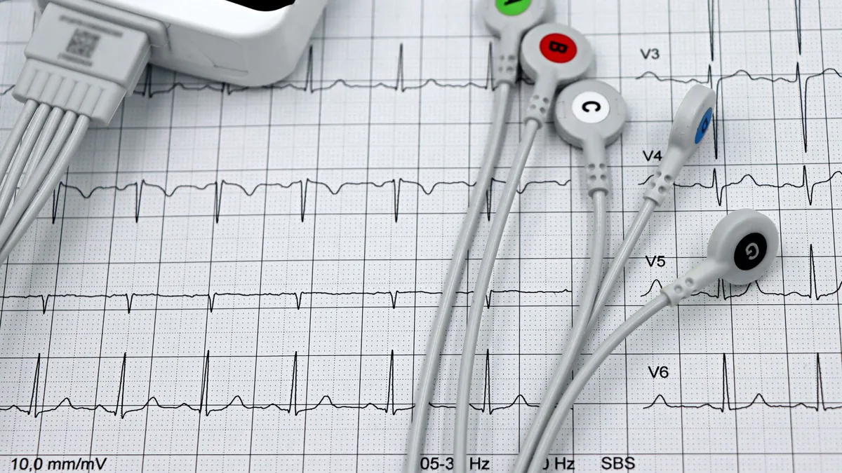 Close-up of ECG monitor leads on a printed cardiogram.