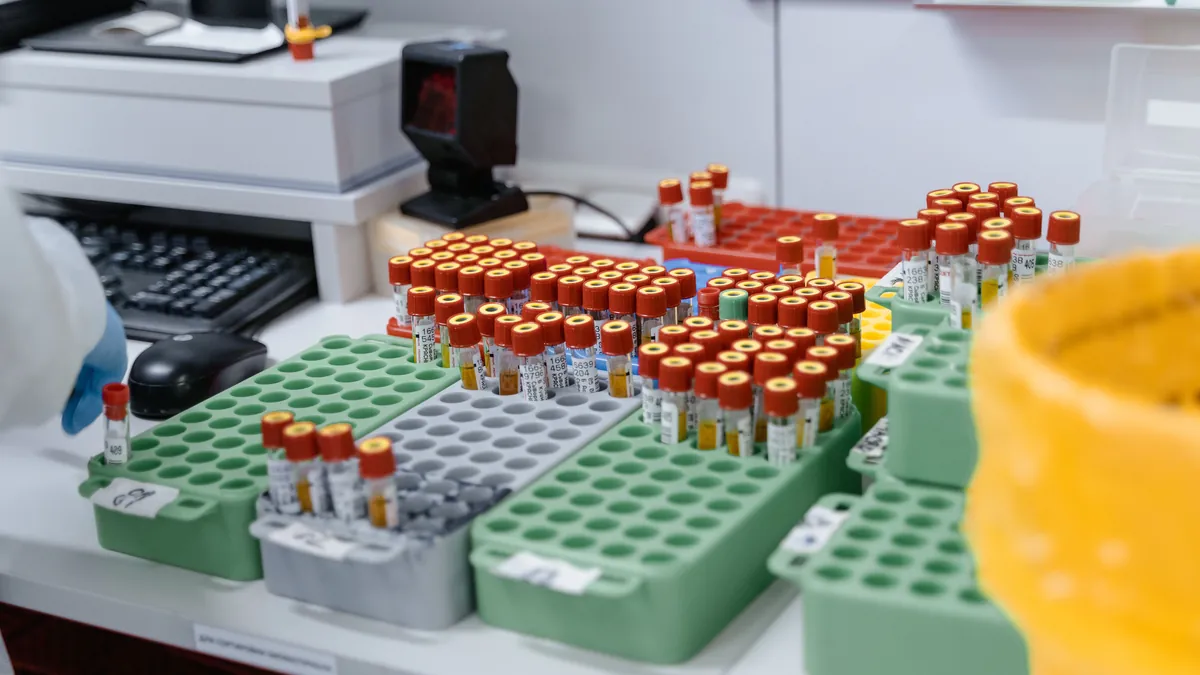Racks of blood samples waiting for processing in a lab, the routine blood work a liver fibrosis score is calculated from