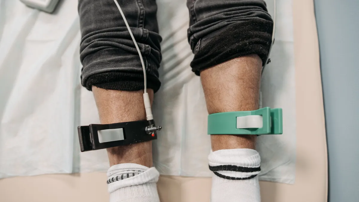 Electrode clips on a patient's lower legs during an in-office test